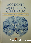 Accidents vasculaires cérébraux