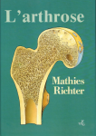 L'arthrose
